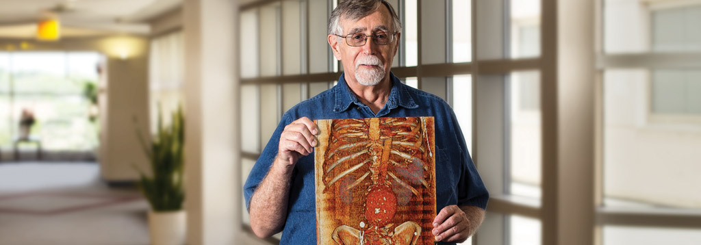 John Defeo standing in hospital hallway, holding up an illustrated image of a skeleton and stomach.