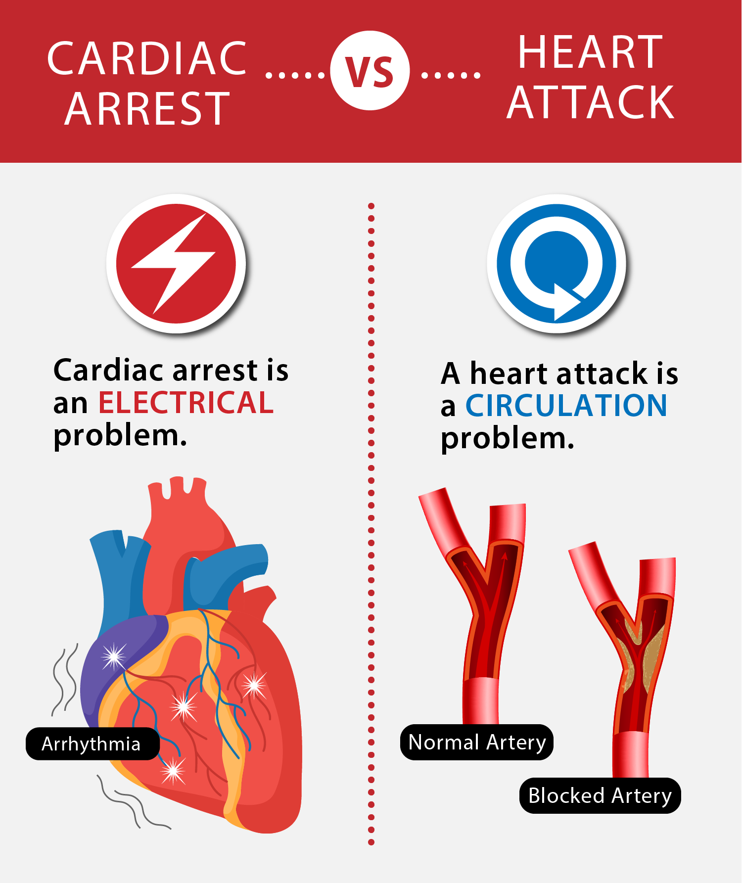 Arrest cardiac Cardiac arrest