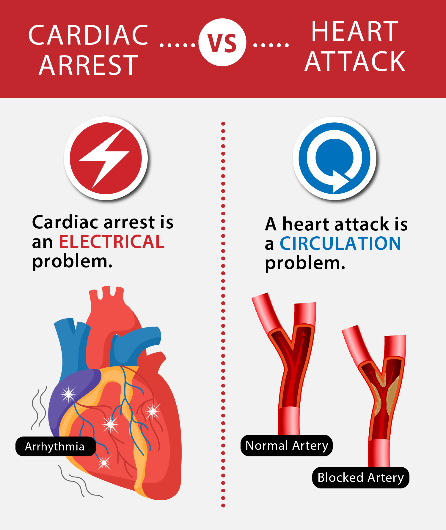 Heart Attack Vs Sudden Cardiac Arrest Know The Signs Grand View Health